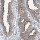 Immunohistochemical staining of human fallopian tube shows moderate cytoplasmic positivity in glandular cells.