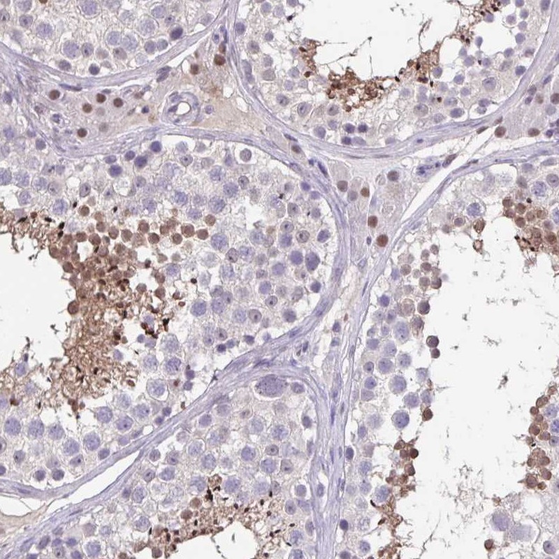 Anti-ACTRT3 Antibody