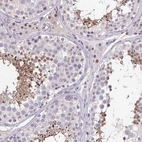 Anti-ACTRT3 Antibody