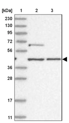 Lane 1: Marker [kDa] 230, 130, 95, 72, 56, 36, 28, 17, 11_br/_Lane 2: Human cell line RT-4_br/_Lane 3: Human cell line U-251MG sp