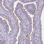Immunohistochemical staining of human Fallopian tube shows strong positivity in cilia in glandular cells.