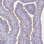 Anti-ABHD5 Antibody