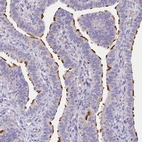 Immunohistochemical staining of human Fallopian tube shows strong positivity in cilia in glandular cells.