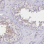 Immunohistochemical staining of human testis shows moderate cytoplasmic positivity in a small subset of cells in seminiferous ducts.