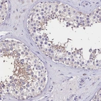 Immunohistochemical staining of human testis shows moderate cytoplasmic positivity in a small subset of cells in seminiferous ducts.