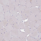 Anti-ABHD5 Antibody