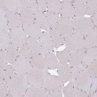 Immunohistochemical staining of human skeletal muscle shows no positivity in myocytes as expected.