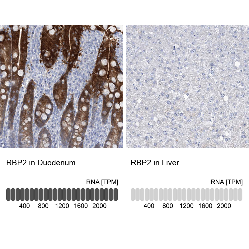 Anti-RBP2 Antibody