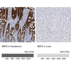Anti-RBP2 Antibody