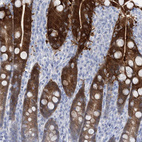 Immunohistochemical staining of human duodenum shows strong cytoplasmic positivity in glandular cells.