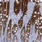 Immunohistochemical staining of human duodenum shows strong cytoplasmic positivity in glandular cells.