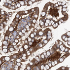 Immunohistochemical staining of human small intestine shows strong cytoplasmic positivity in glandular cells.