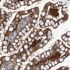 Immunohistochemical staining of human small intestine shows strong cytoplasmic positivity in glandular cells.