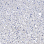 Immunohistochemical staining of human liver shows no positivity in hepatocytes as expected.