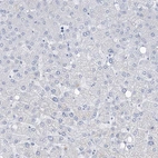 Immunohistochemical staining of human liver shows no positivity in hepatocytes as expected.