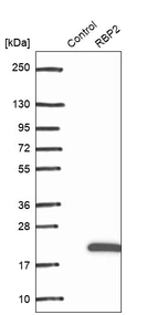 Western blot analysis in control (vector only transfected HEK293T lysate) and RBP2 over-expression lysate (Co-expressed with a C-terminal myc-DDK tag (~3.1 kDa) in mammalian HEK293T cells, LY418171).