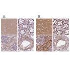 Anti-ADD1 Antibody