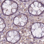 Immunohistochemical staining of human colon using Anti-ADD1 antibody HPA035874.