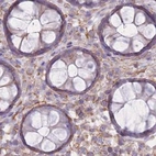 Immunohistochemical staining of human colon using Anti-ADD1 antibody HPA035874.