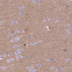 Immunohistochemical staining of human cerebral cortex using Anti-ADD1 antibody HPA035874.
