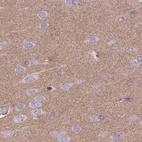 Immunohistochemical staining of human cerebral cortex using Anti-ADD1 antibody HPA035874.