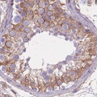 Immunohistochemical staining of human testis using Anti-ADD1 antibody HPA035874.