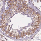 Immunohistochemical staining of human testis using Anti-ADD1 antibody HPA035874.