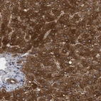 Immunohistochemical staining of human liver shows strong cytoplasmic positivity in hepatocytes.