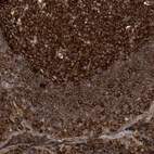 Immunohistochemical staining of human tonsil shows strong cytoplasmic positivity in germinal center cells.