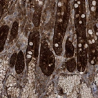 Immunohistochemical staining of human duodenum shows strong cytoplasmic positivity in glandular cells.