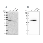 Western blot analysis using Anti-PAICS antibody HPA035895 (A) shows similar pattern to independent antibody HPA041538 (B).