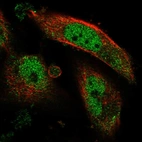 Immunofluorescent staining of human cell line U-251 MG shows localization to nucleoplasm & cytosol.