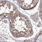 Immunohistochemical staining of human testis shows strong cytoplasmic positivity in cells in seminiferous ducts.
