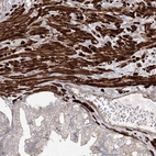 Immunohistochemical staining of human prostate shows strong cytoplasmic positivity in smooth muscle cells.