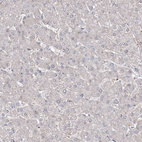 Anti-ZSWIM6 Antibody