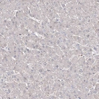 Immunohistochemical staining of human liver shows no positivity in hepatocytes as expected.