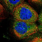 Immunofluorescent staining of human cell line A-431 shows localization to cytosol.