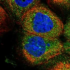 Immunofluorescent staining of human cell line A-431 shows localization to cytosol.