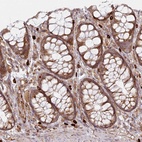 Anti-HARS2 Antibody