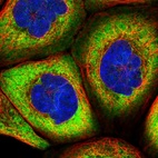 Immunofluorescent staining of human cell line A-431 shows localization to cytosol.