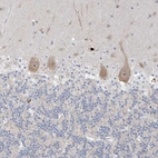 Anti-SDAD1 Antibody