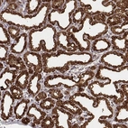 Immunohistochemical staining of human lactating breast shows strong cytoplasmic positivity in glandular cells.
