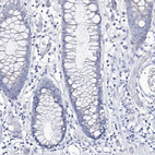 Immunohistochemical staining of human colon shows no positivity in glandular cells as expected.