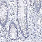 Immunohistochemical staining of human colon shows no positivity in glandular cells as expected.