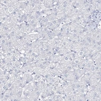 Immunohistochemical staining of human liver shows no positivity in hepatocytes as expected.