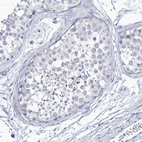 Immunohistochemical staining of human testis shows no positivity in cells in seminiferous ducts as expected.