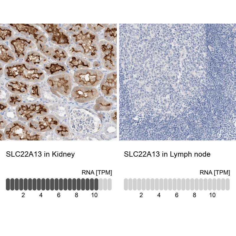 Anti-SLC22A13 Antibody