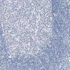Anti-SLC22A13 Antibody