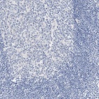 Immunohistochemical staining of human lymph node shows low expression as expected.