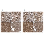Anti-MUT Antibody